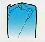 The failure mode of the drill bit: The nose of tool has plastic deformation